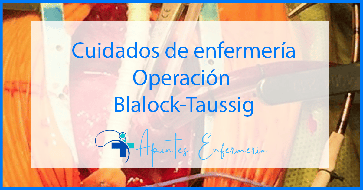 Operación Blalock-Taussig