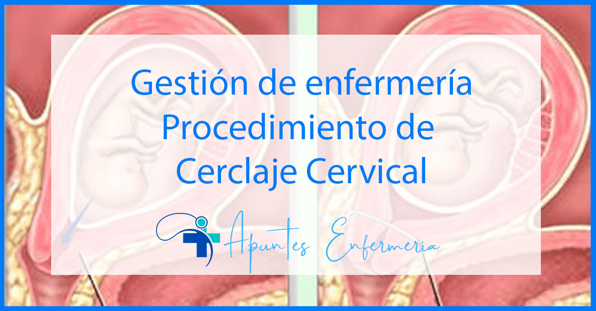 Procedimiento de cerclaje cervical