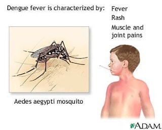 Dengue hemorrágico