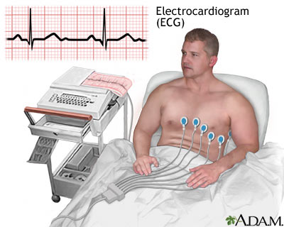 Electrocardiografía (ECG)