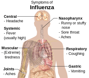 Influenza (gripe)