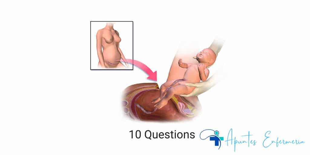 Examen práctico de parto por cesárea