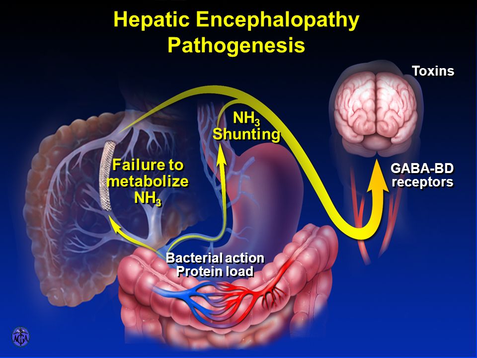 Encefalopatía hepática Manejo de enfermería